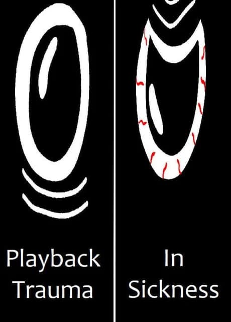 Playback Trauma: In Sickness
