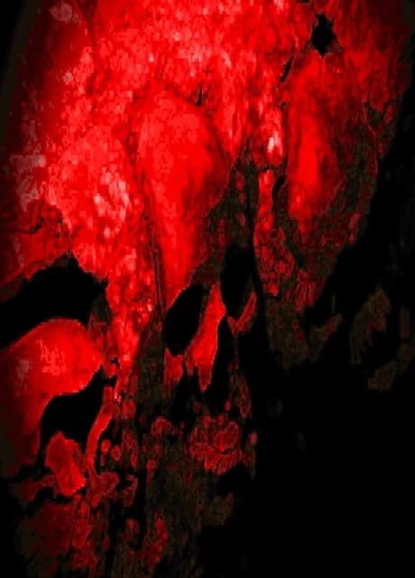 Scorn