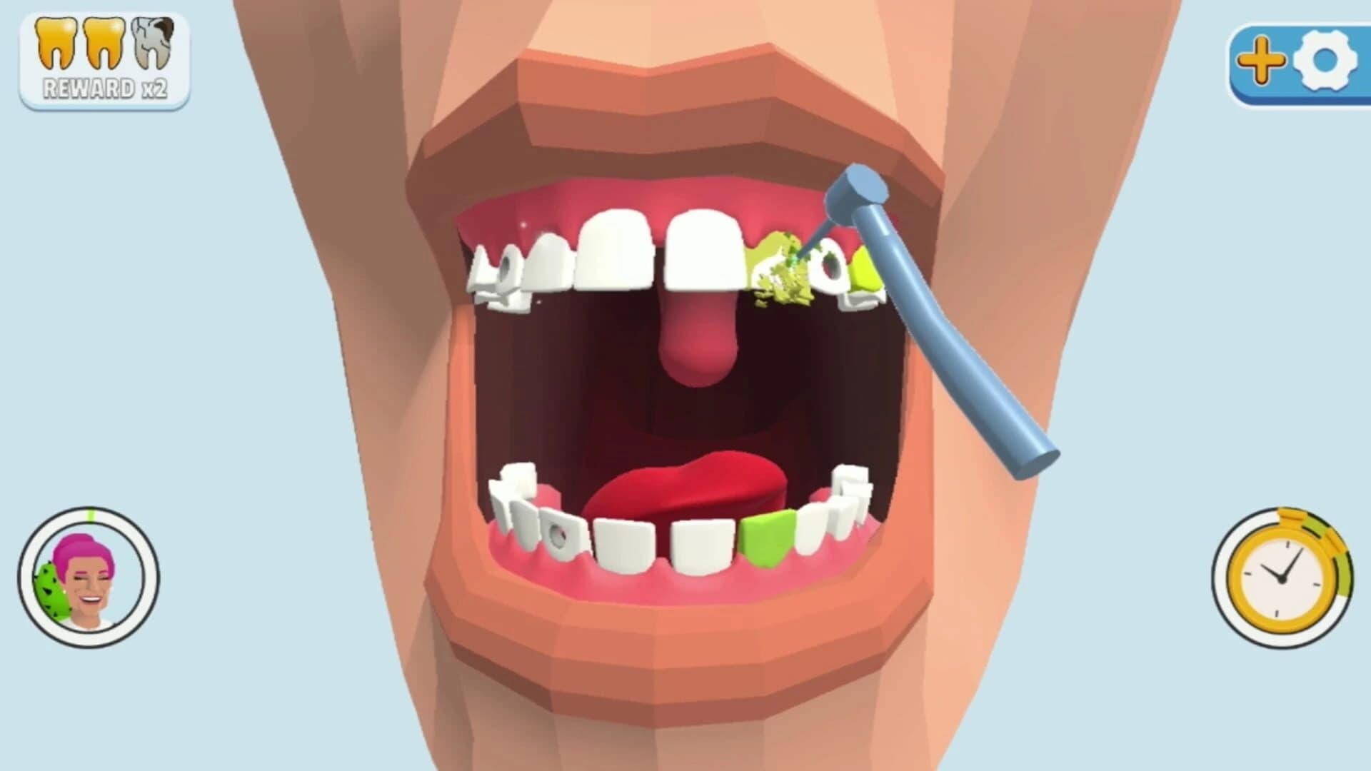 Dentist Bling screenshot 4