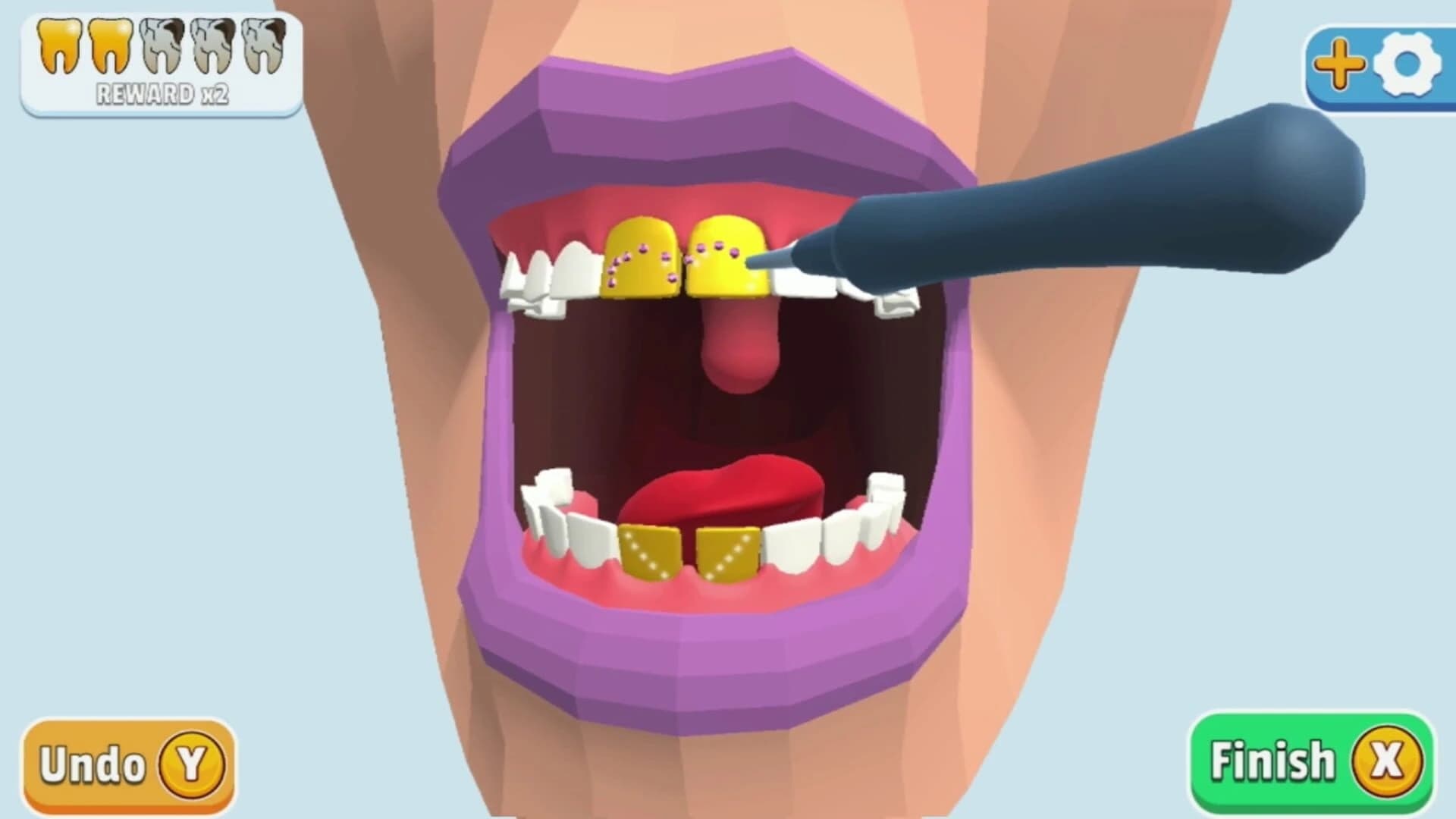 Dentist Bling screenshot 1